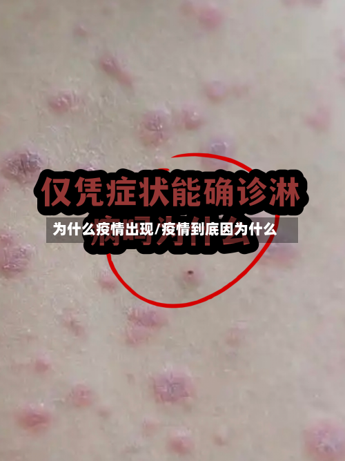 为什么疫情出现/疫情到底因为什么-第2张图片