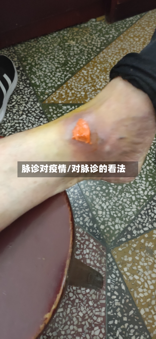 脉诊对疫情/对脉诊的看法-第1张图片