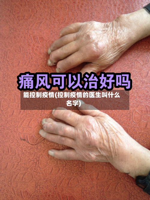 能控制疫情(控制疫情的医生叫什么名字)-第2张图片