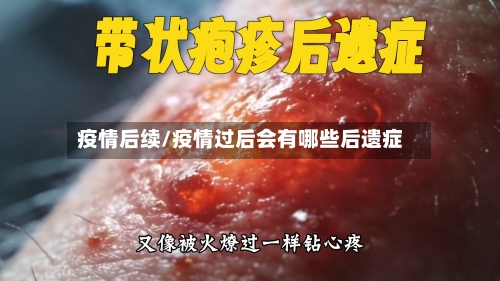 疫情后续/疫情过后会有哪些后遗症-第1张图片